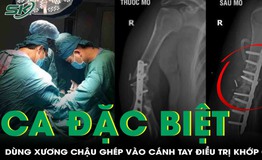 Ca phẫu thuật đặc biệt: D&#249;ng xương chậu t&#225;i tạo c&#225;nh tay tổn thương
