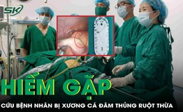 Hiếm gặp: Bệnh nh&#226;n bị xương c&#225; đ&#226;m thủng ruột thừa, được phẫu thuật cứu sống
