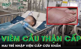 Ph&#249; mặt, sưng ch&#226;n kh&#244;ng r&#245; nguy&#234;n nh&#226;n, hai trẻ nhập viện khẩn vi&#234;m cầu thận cấp
