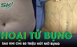 Chi 80 triệu l&#224;m đẹp, người phụ nữ hoại tử bụng sau khi h&#250;t mỡ 