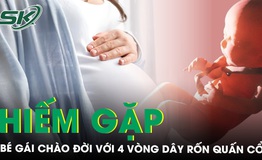 B&#233; g&#225;i ch&#224;o đời với 4 v&#242;ng d&#226;y rốn quấn cổ cực hiếm gặp