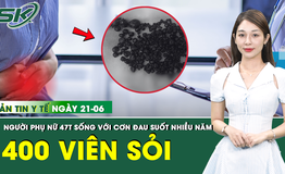 Bản tin Y tế 21/6: Đau bụng dữ dội do 400 vi&#234;n sỏi &#39;chen ch&#250;c&#39; trong t&#250;i mật