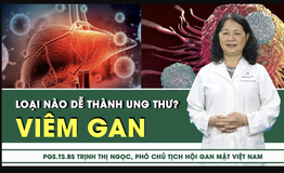  Vi&#234;m gan loại n&#224;o dễ tiến triển th&#224;nh ung thư? 