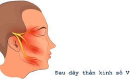 Gợi &#253; c&#225;ch bấm c&#225;c huyệt vị gi&#250;p giảm đau d&#226;y thần kinh tam thoa