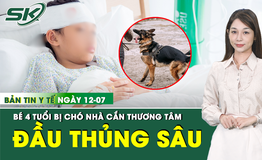 Bản Tin Y Tế 12/7: Thương t&#226;m: Bị ch&#243; nh&#224; cắn, b&#233; 4 tuổi đầu thủng s&#226;u