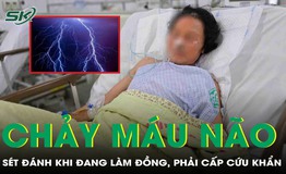 Chảy m&#225;u n&#227;o v&#236; s&#233;t đ&#225;nh khi đang l&#224;m đồng, người phụ nữ nguy kịch phải cấp cứu khẩn 
