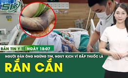 Bản Tin Y Tế 18/7: Bị rắn hổ mang ch&#250;a cắn, người đ&#224;n &#244;ng ngừng tim, h&#244;n m&#234; sau đắp thuốc l&#225;