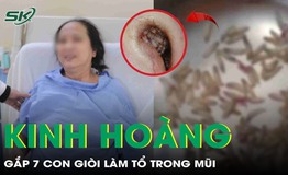 Ổ gi&#242;i l&#224;m tổ c&#249;ng dị vật sỏi trong hốc mũi khiến người phụ nữ nghẹt mũi, chảy m&#225;u li&#234;n tục