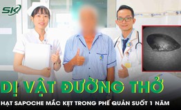 Tưởng mắc bệnh h&#244; hấp m&#227;n t&#237;nh, kh&#244;ng ngờ ph&#225;t hiện hạt hồng xi&#234;m kẹt trong phế quản