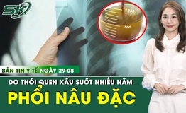 Bản Tin Y Tế 29/8: Phổi đặc với 30 lít dịch đục ngầu do thói quen khó bỏ