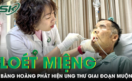 Chủ quan với vết lo&#233;t miệng, người đ&#224;n &#244;ng b&#224;ng ho&#224;ng nhận kết quả ung thư giai đoạn muộn