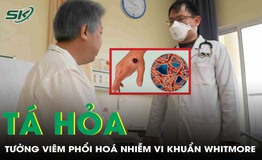 Tưởng vi&#234;m phổi, người đ&#224;n &#244;ng t&#225; hỏa ph&#225;t hiện nhiễm vi khuẩn Whitmore