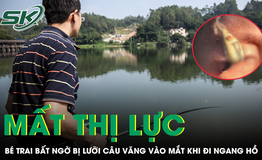 Đi ngang hồ câu, bé trai bất ngờ bị lưỡi câu văng vào mắt và có nguy cơ mất thị lực vĩnh viễn