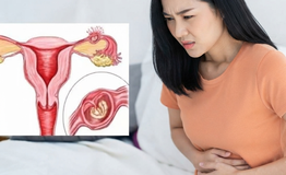 Dấu hiệu mang thai ngoài tử cung cần nhận biết sớm