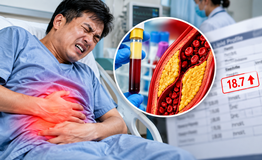Đau bụng dữ dội, nhập viện phát hiện chỉ số mỡ máu cao gấp gần 20 lần