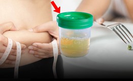 Nhịn ăn giảm cân, người phụ nữ 30 tuổi phát hiện tiểu đường, nước tiểu đầy bọt