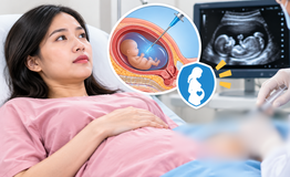 Được chỉ định chọc ối, mẹ bầu cần biết ngay những điều này