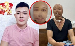 Ngã úp mặt vào nước sôi, chàng trai 31 tuổi mất thị lực, gương mặt biến dạng