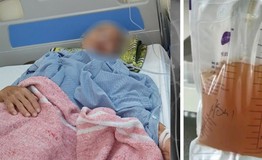 Bác sĩ hút 2,5 lít dịch mỗi ngày từ lồng ngực cụ bà
