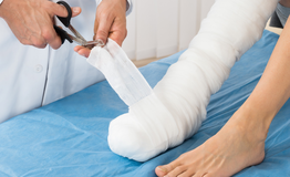 Sẹo bỏng co rút khiến bé trai 9 tuổi phải bò bằng tay