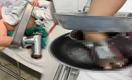 Nữ đầu bếp gặp tai nạn kinh hoàng khi xay thịt phải cắt bỏ 3 ngón tay