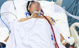 'Em nó mới hơn 30 tuổi sao lại đột quỵ' - câu hỏi khiến bác sĩ xót xa