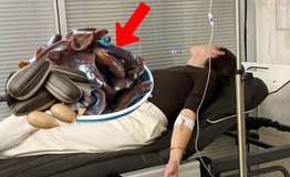 Gia đình 3 người nhập viện sau ăn khuya, nguyên nhân từ 2 món ăn quen thuộc