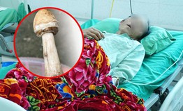 4 người trong một gia đình nhập viện sau bữa cơm có nấm lạ
