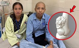 Cậu bé 16 tuổi mồ côi cha từ nhỏ phải cắt một phần chân vì ung thư