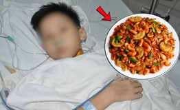 Ăn tôm đồng, bé trai 14 tuổi mẩn đỏ toàn thân nhập viện nguy kịch