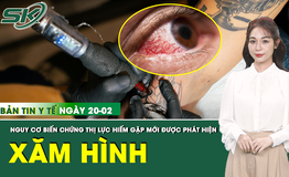 Bản tin Y tế 20/2: Hàng chục người mắc biến chứng thị lực hiếm gặp sau xăm hình