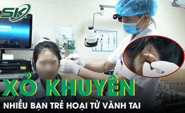Xỏ khuyên, nhiều bạn trẻ nhập viện vì hoại tử vành tai 