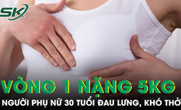 Vòng một nặng gần 5kg khiến người phụ nữ 30 tuổi đau lưng, khó thở