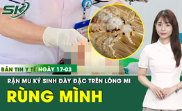 Bản tin Y tế 17/3: Rùng mình rận mu ký sinh dày đặc trên lông mi người phụ nữ 