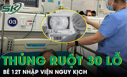 Sốt kéo dài hai tuần, bé trai nhiễm vi khuẩn hiếm khiến ruột thủng hơn 30 lỗ
