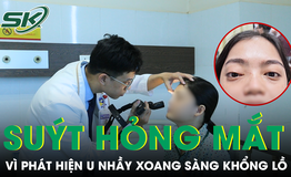 Ngỡ lồi mắt do cường giáp, người phụ nữ suýt hỏng mắt vì phát hiện u nhầy xoang sàng khổng lồ