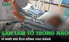 Nhét đùi ếch sống vào răng, người phụ nữ 61 tuổi bị sán ký sinh, làm tổ trong não