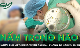 Đau đầu nhiều ngày, người phụ nữ bất ngờ phát hiện nấm nguy hiểm trong não