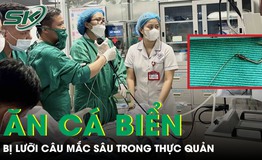 Hiếm gặp: Ăn cá biển, người đàn ông bị lưỡi câu mắc sâu trong thực quản