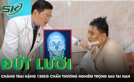 Cứu chàng trai nặng 130 kg đứt lưỡi sau tai nạn giao thông