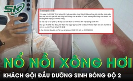 Nổ nồi xông hơi khi gội đầu dưỡng sinh, nữ khách bỏng độ 2 vùng cổ và ngực 