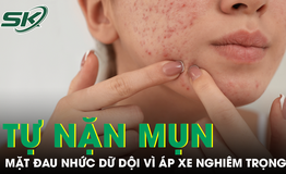 Tự nặn mụn quanh môi, cô gái nhập viện vì áp xe mặt, nhiễm vi khuẩn kháng thuốc
