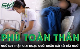 Phù toàn thân, ngỡ suy thận giai đoạn cuối, nam thanh niên 21 tuổi nhận cái kết bất ngờ