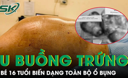 Bé gái 16 tuổi mang hai khối u buồng trứng khổng lồ gần 15kg, biến dạng toàn bộ ổ bụng