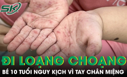 Tưởng bệnh nhẹ, bé gái 10 tuổi nhập viện nguy kịch vì tay chân miệng biến chứng thần kinh