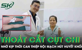 Thoát nguy cơ cắt cụt chi nhờ can thiệp nội mạch hút huyết khối 