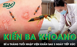 Bé 6 tháng tuổi nhập viện sau tiếp xúc kiến ba khoang, bác sĩ chỉ dấu hiệu nguy hiểm