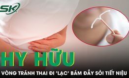 Ngỡ viêm đường tiết niệu, người phụ nữ bất ngờ phát hiện vòng tránh thai 'lạc' vào bàng quang