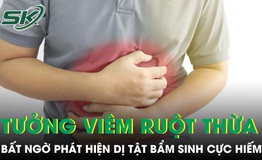 Đau bụng tưởng viêm ruột thừa cấp, bất ngờ phát hiện mắc dị tật bẩm sinh chỉ 2% người mắc 