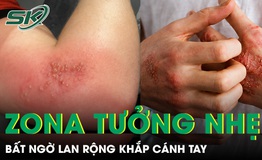 Zona tưởng nhẹ bất ngờ lan rộng khắp cánh tay khiến du khách trẻ nhập viện 